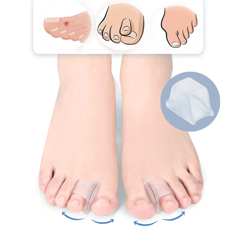 Orthopedic Toe Separator for Big Toe